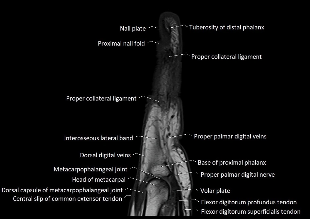 Finger anatomy sagittall cross section 3T image 8.webp